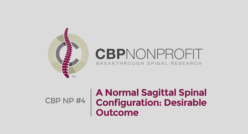 CBP NP #4: A Normal Sagittal Spinal Configuration: Desirable Outcome
