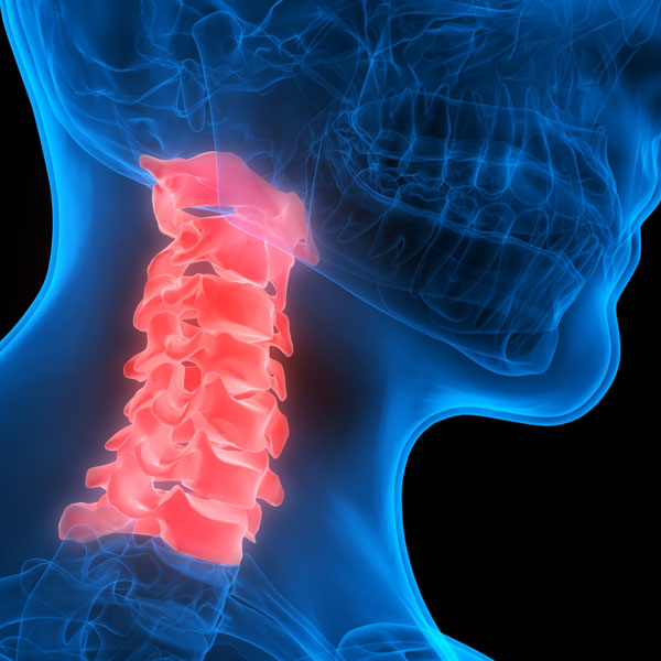 Positive Outcomes with Tourett’s Syndrome in a Patient Receiving Chiropractic BioPhysics Treatment to Improve A Cervical Kyphosis: A CBP Case Report