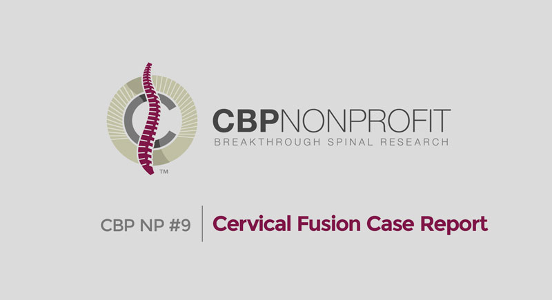 CBP NP #9: Cervical Fusion Case Report